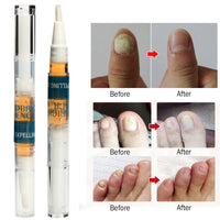 Solution Anti Fongique Infection Nail Bright Pencil Fungal Treatment Anti Fungus Biological Repair 3ml Restores Healthy Nail
